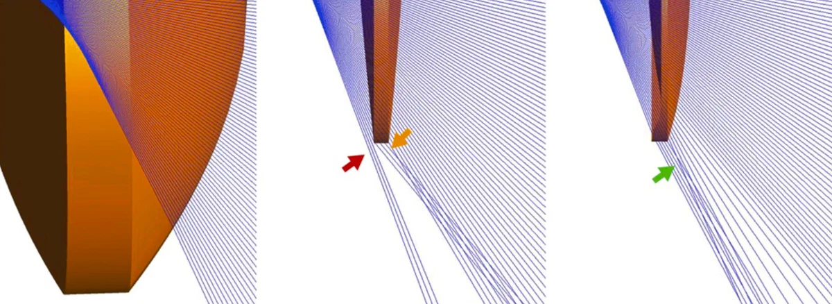 Ray tracing through intraocular lens edge illustrating negative dysphotopsia