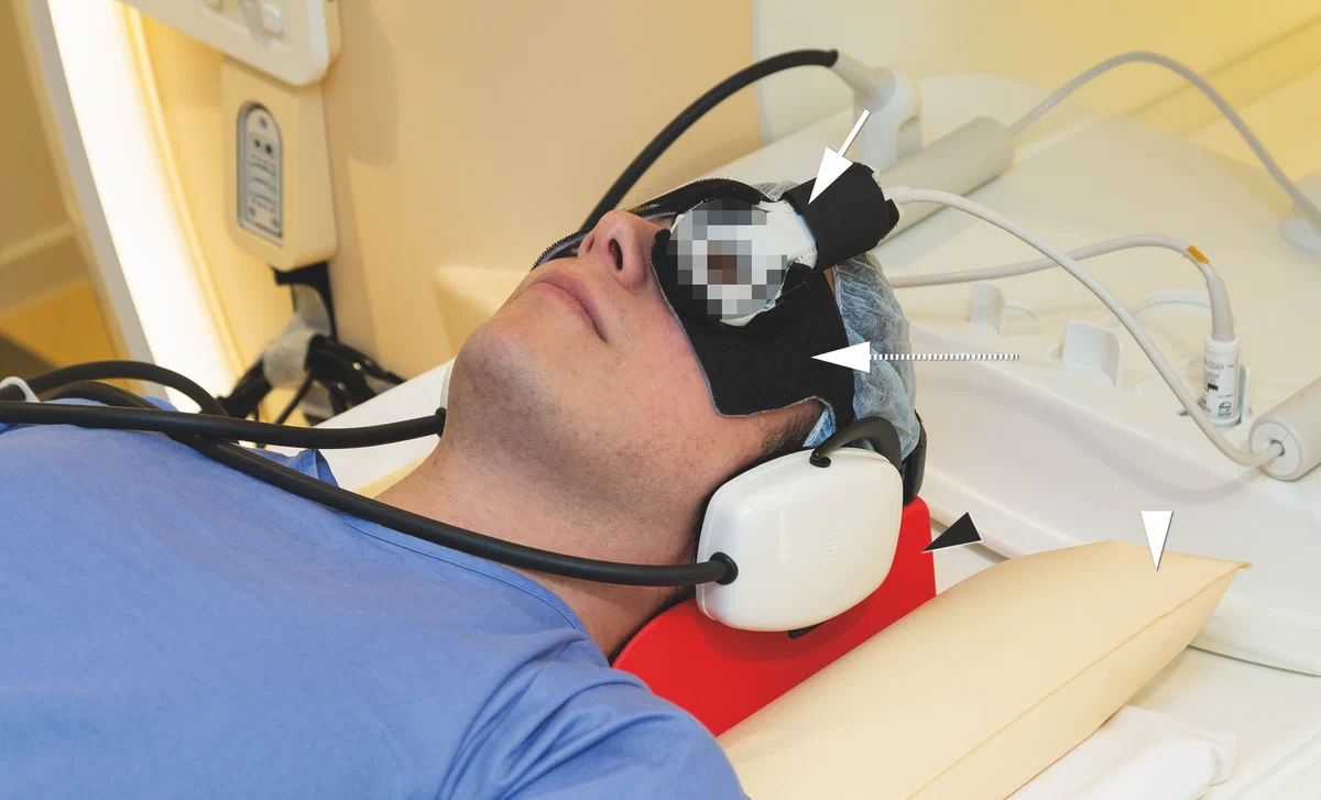Eye coil MRI hardware used for high-resolution ocular imaging
