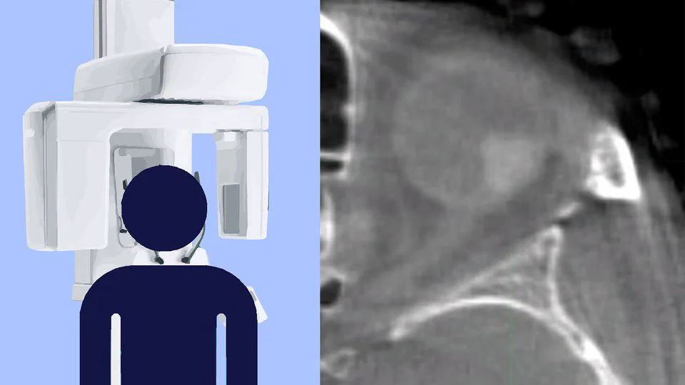 Project to develop ocular CBCT funded