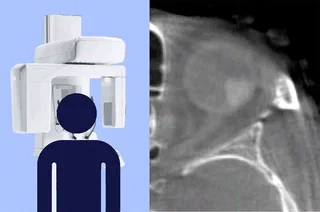 Dutch Research Council NWO grant awarded for developing an ocular cone-beam CT scanner
