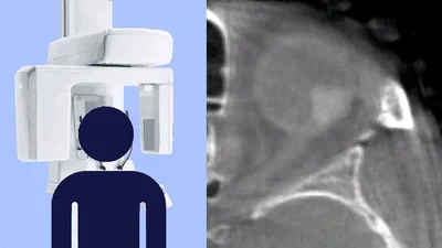 Dutch Research Council NWO grant awarded for developing an ocular cone-beam CT scanner