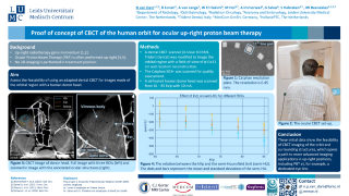 Proof of concept of CBCT of the human orbit for ocular up-right proton beam therapy