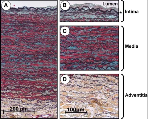 Histology panels of the porcine aortic wall showing layered anatomy and extracellular matrix components with Movat pentachrome staining.