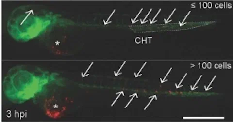 Microscopy images of zebrafish tumor xenografts illustrating tumor growth, vascularization, and neutrophil-associated invasion and metastasis.