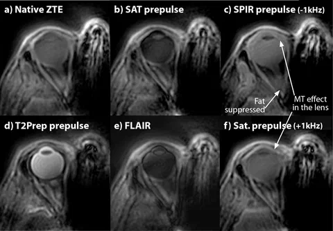 Magnetization-prepared eye ZTE imaging
