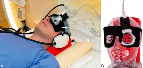 Clinical setup for ocular MRI showing head stabilization and positioning of the dedicated eye coil and goggles.