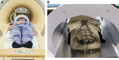 Setup for high-resolution ocular MRI using a dedicated eye coil, projected fixation target, and cued-blinking to reduce motion artifacts.