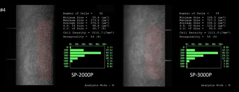 Endothelial cell photographs illustrating a systematic difference in measured endothelial cell count between Topcon SP-2000P and SP-3000 corneal specular microscopes.