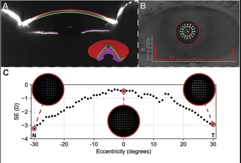 Overview of clinical measurements including anterior segment tomography, biometry, and peripheral ocular aberration assessment.