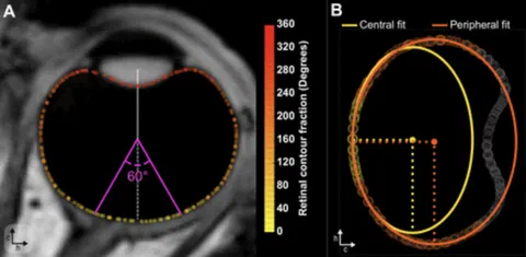 3D ellipsoid fitting results versus retinal contour fraction, including radii, center coordinates, and fit distance.
