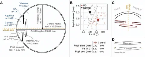 Eye model specifications including anterior chamber geometry in negative dysphotopsia versus controls and schematic IOL design details.