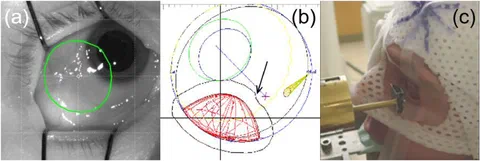 Overview of possible intraocular measurements for ocular proton therapy.