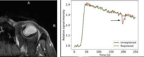 Overview of the DCE-MRI analysis pipeline including tumor delineation, image registration, T1 mapping, and pharmacokinetic modeling.