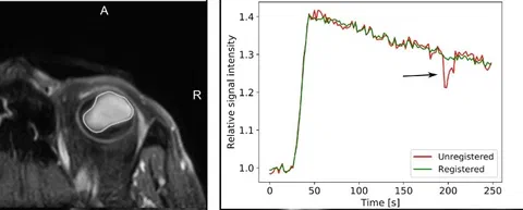 Overview of the DCE-MRI analysis pipeline including tumor delineation, image registration, T1 mapping, and pharmacokinetic modeling.