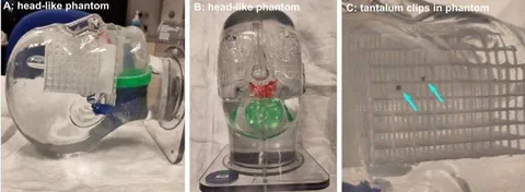 Head-like phantom set-up with tantalum clips and grid landmarks identified across MRI, X-ray, and CT images.