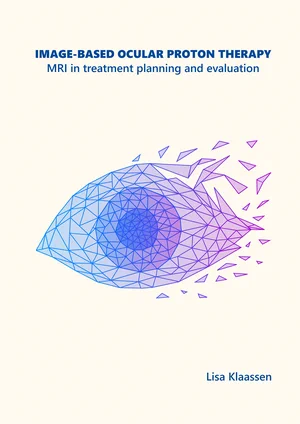 Image-based ocular proton therapy