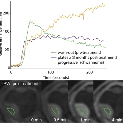 Systematic review of MRI in clinical care for uveal melanoma