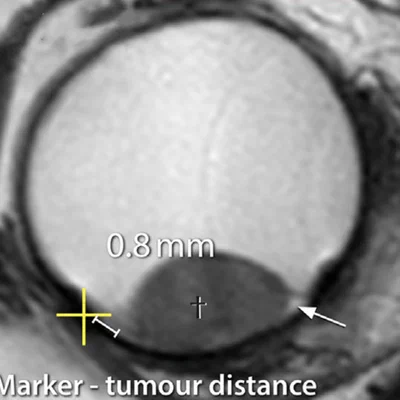 Comparison of MRI-based and conventional proton therapy measurements