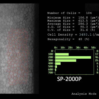Corneal specular microscopy image for endothelial cell analysis