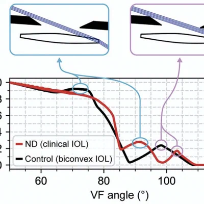 Effect of IOL design and eye anatomy on negative dysphotopsia